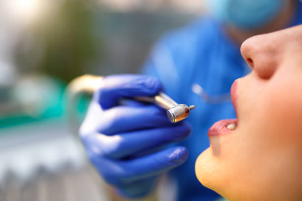 Dental Inlays and Onlays in Duchesne, UT
